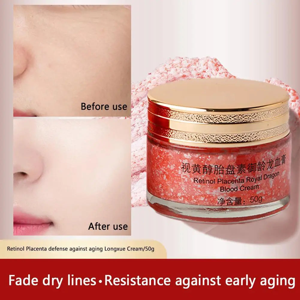 Dragons Blood Easy Cream, Retinol Placenta Dragon Blood Face Cream, Firm Anti Wrinkle Cream For Women Rejuvenate Skin Care 50g